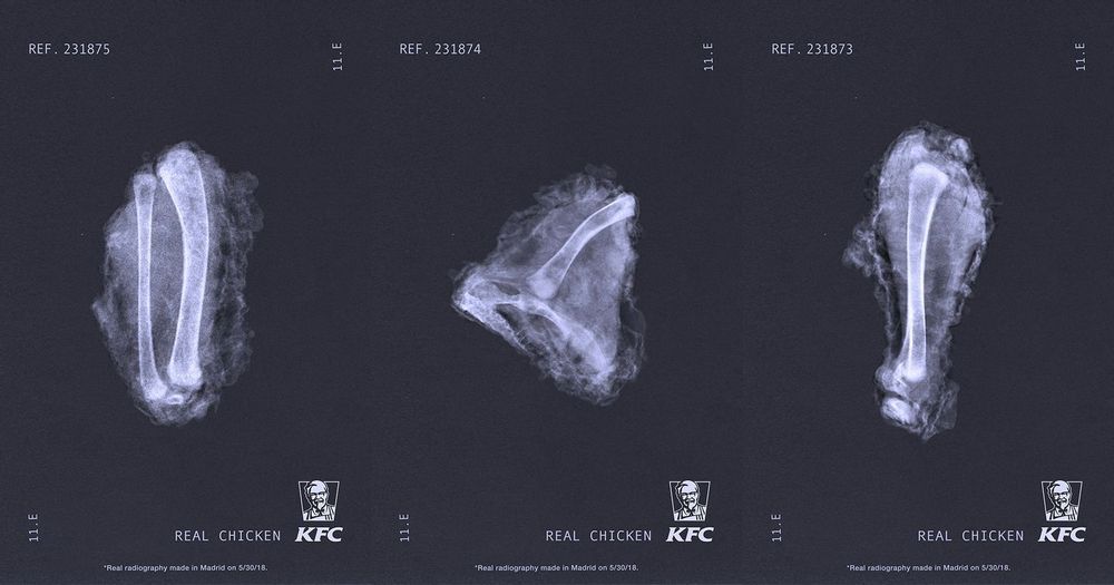 KFC từng sử dụng những print-ads X quang miếng gà để chứng minh tính xác thực của sản phẩm